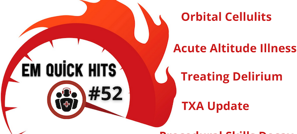 EM Quick Hits 52